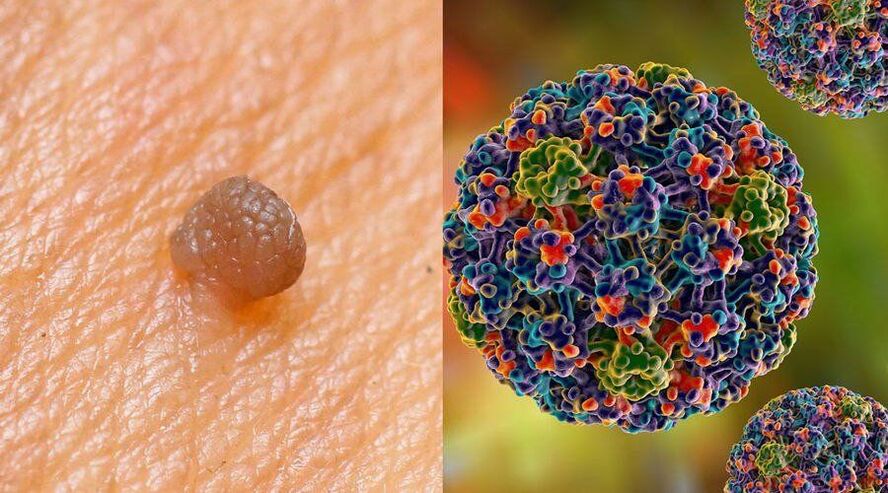Ways of transmission of HPV