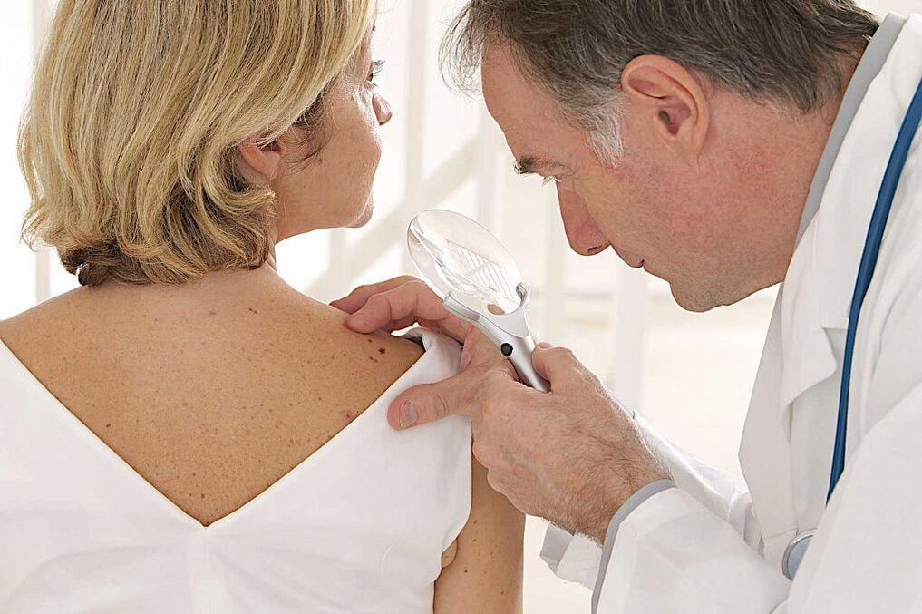 diagnosis of human papilloma virus